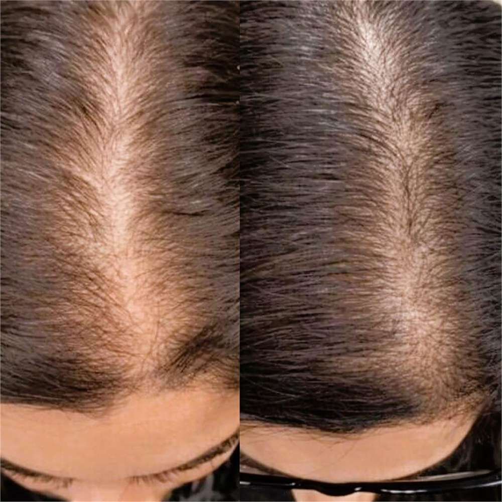 Customer before-and-after scalp photo shared in an Etsy review for House of Herbs Hair Growth Oil.